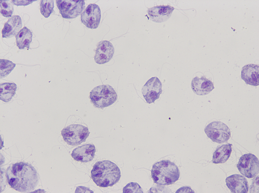 microscopic view of tritrichomonas foetus