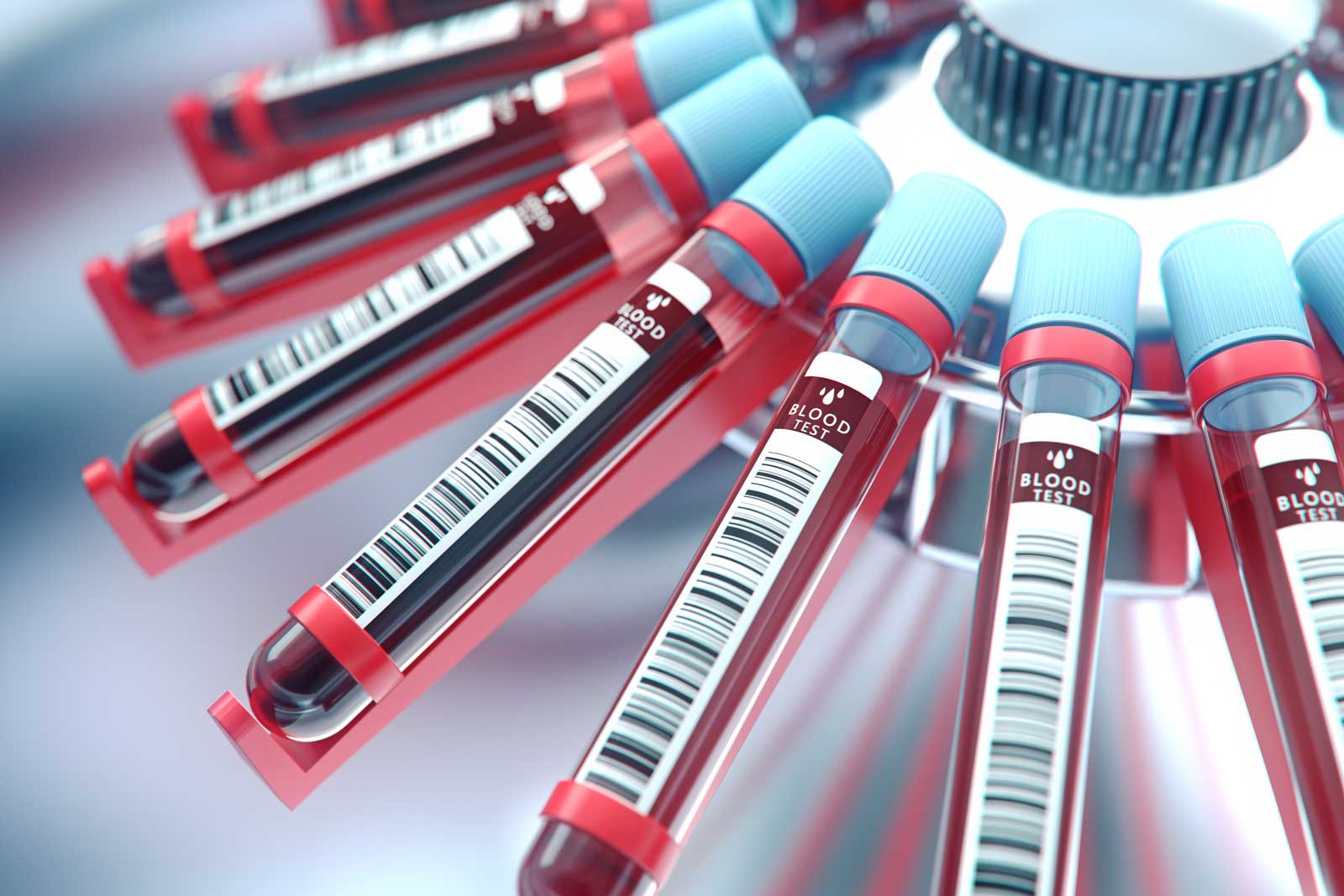 blood samples aligned in cetrifuge