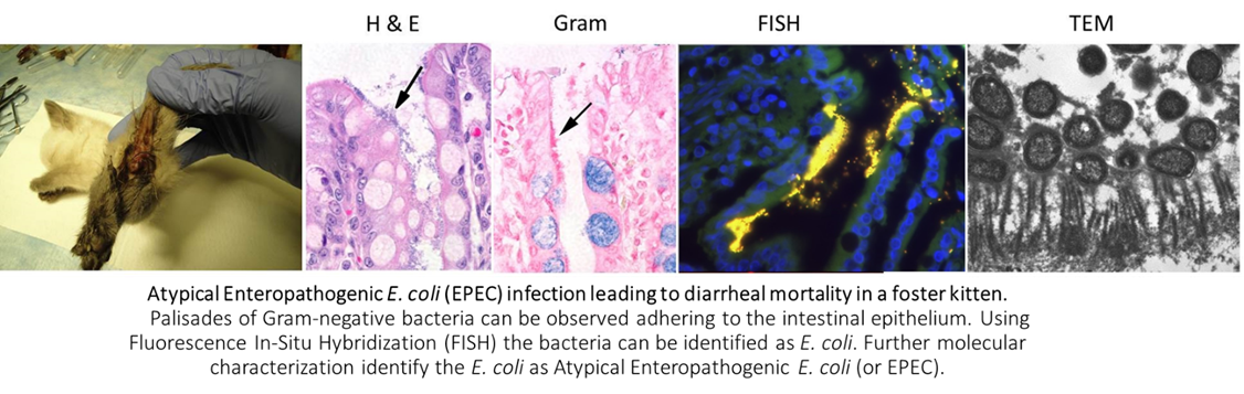 case study slides of atypical enteropathogenic E. coli infection